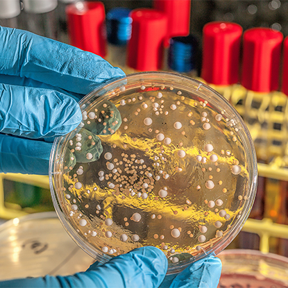 Kontrola zdrowia i chorób